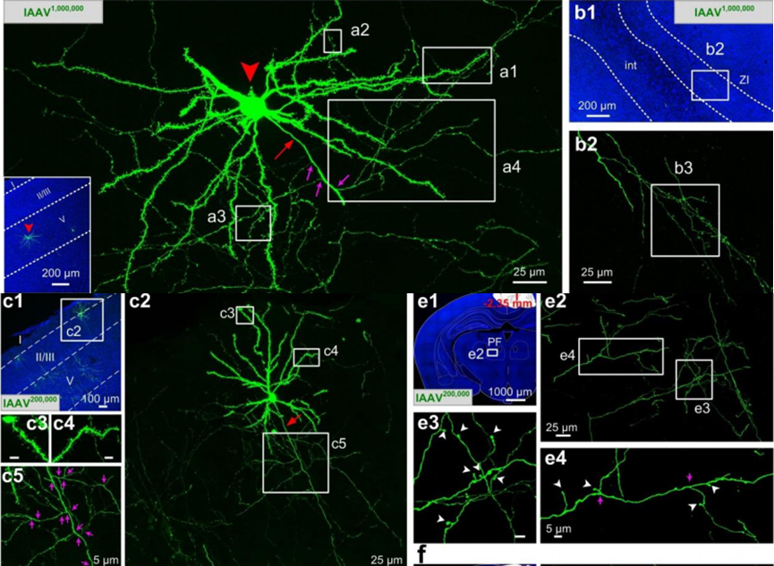  Fine structures of individual neurons labeled with lAAV1,000,000 and lAAV200,000.