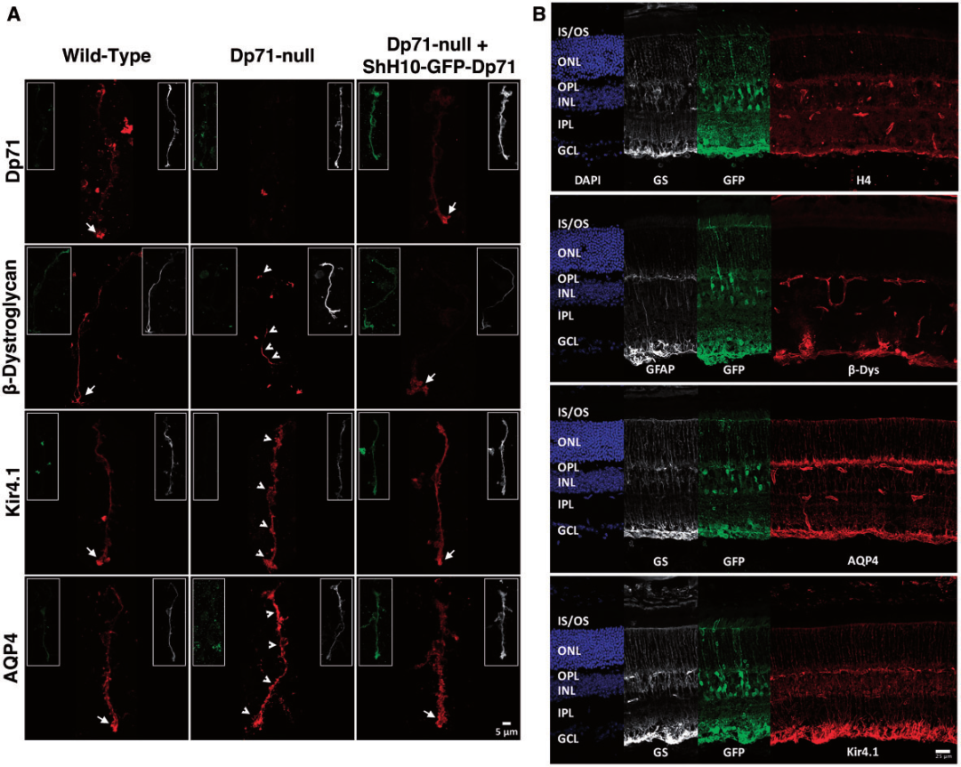  AAV2/Retro mediated retrograde labeling(D. Gowanlock R. Tervo etal.,2016)