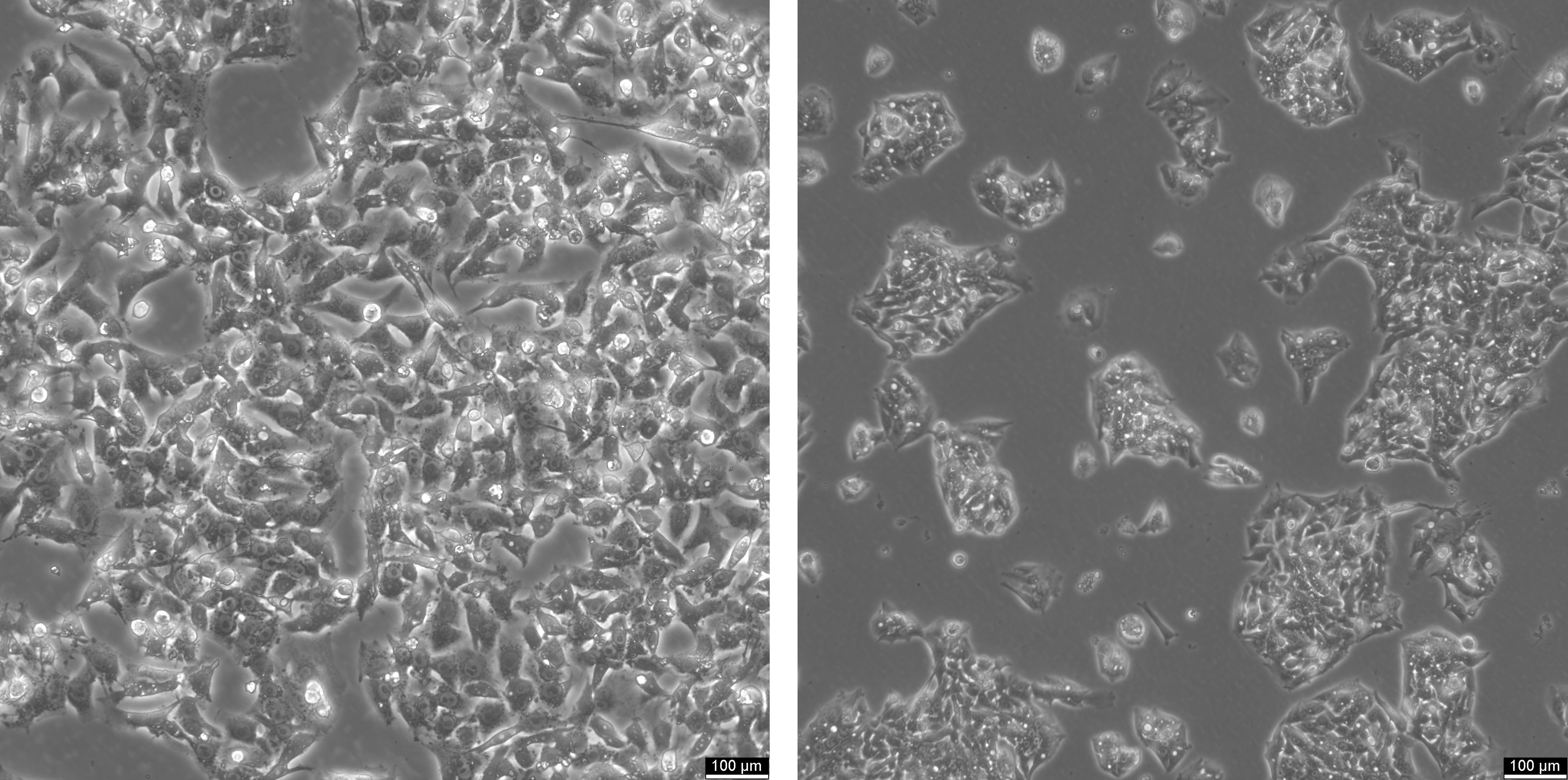 HepG2 cells at high and low confluences